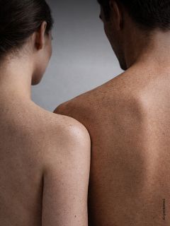 Une femme et un homme se tiennent dos à dos, tous deux torse nu, et montrent leurs épaules et leurs dos couverts de taches de rousseur devant un fond neutre.
