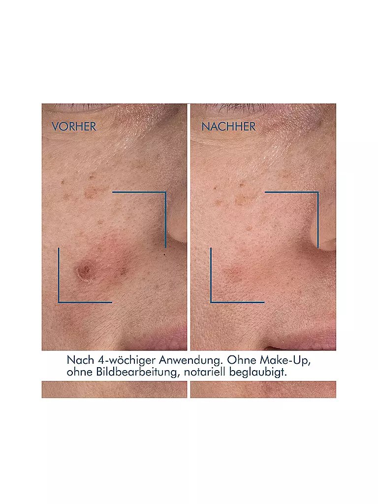 BIOTHERM | Blue Retinol Sérum Nuit 30ml | 