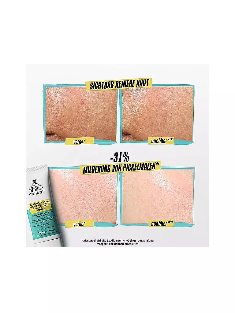 KIEHL'S | Crème pour le visage - Lotion traitante et préventive anti-imperfections Expertly Clear 60 ml | Aucune couleur
