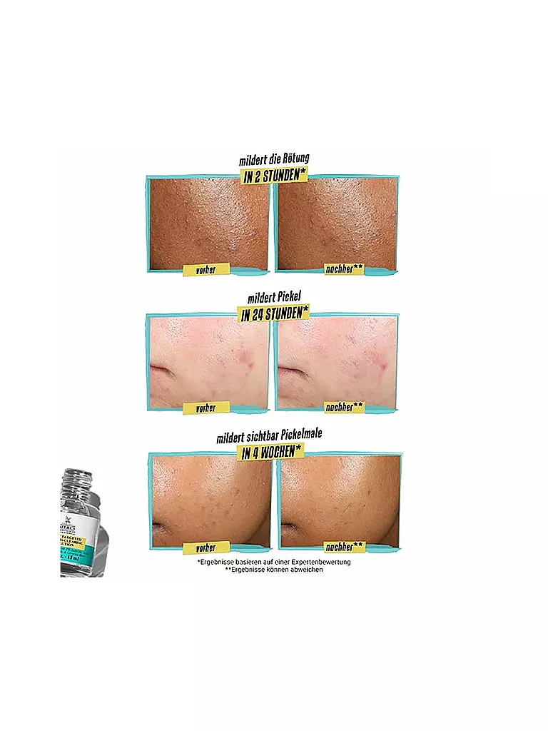 KIEHL'S | Truly Targeted Blemish Clearing Solution 15ml | 