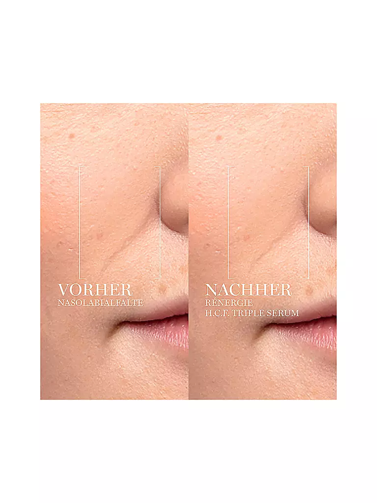 LANCÔME | Rénergie Multi-Lift Ultra Triple Serum 50ml | 