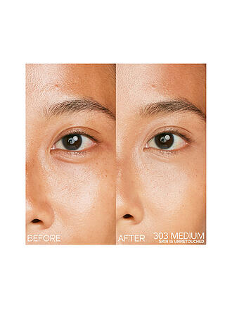 SHISEIDO | Synchro Skin Radiant Lifting Concealer 203